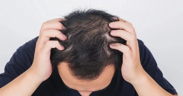 比皺紋更暴露年齡的，是這個地方……