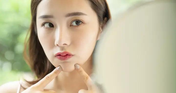 下頜、嘴下總冒硬痘痘？5個原因很多人一直搞錯