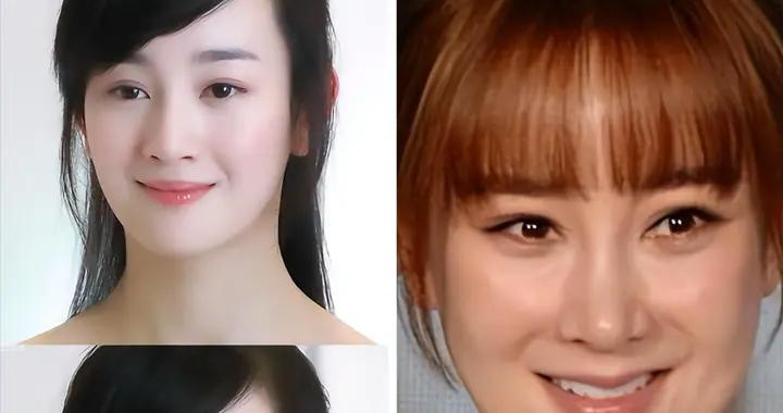 比發腮更可怕的是“長相饅化”！顯老不說，看着還像“整容臉”