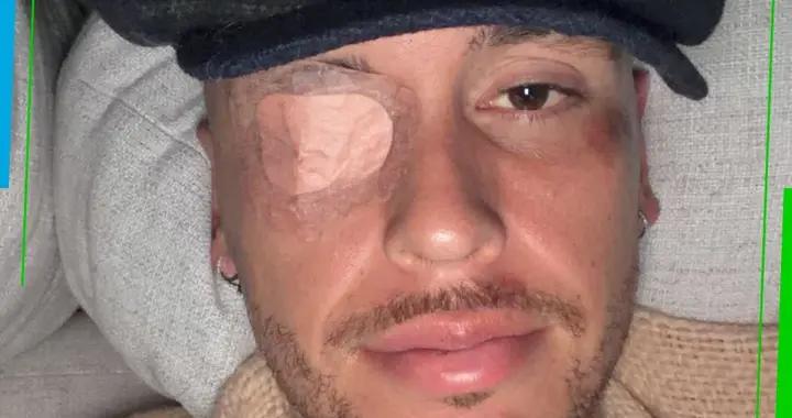 早日康復，阿根廷前國腳奧坎波斯左臉面癱，已在接受治療