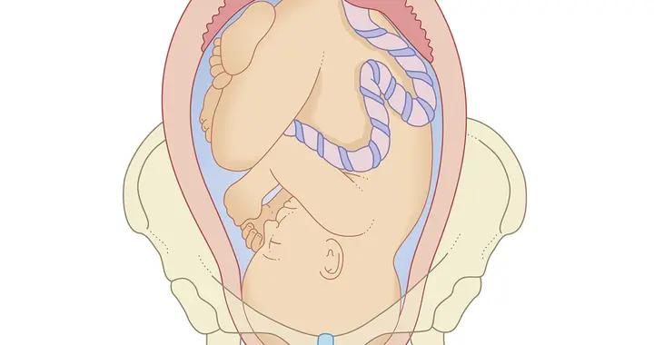 孕晚期胎兒蜷縮身子倒立頭朝下，會不會難受？醫生：胎寶心疼媽媽