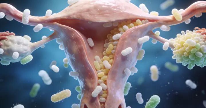 瘙癢、白帶多？皆因溼熱，送你一箇中藥方，清熱燥溼，私處清爽