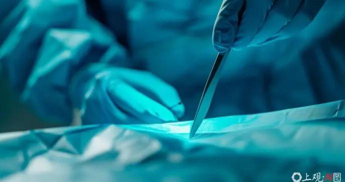 胃癌手術淋巴結清掃“要徹底”，觀念要改了！事關患者未來生存率