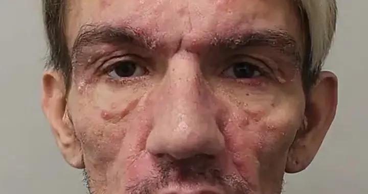 英國一男子隱瞞艾滋病與超400男子發生性關係，真是服了！