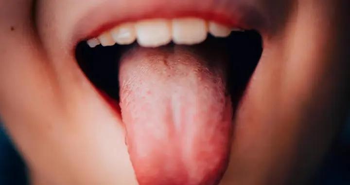 舌頭藏“裂紋”？可能是營養不夠或疾病信號