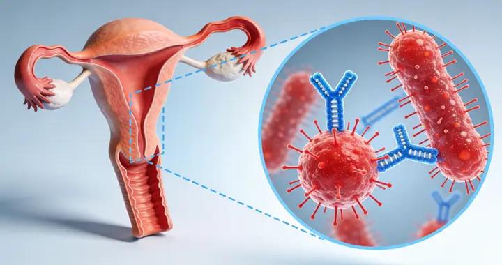 炎症反覆、坐立難安？芩苓子陰道灌注液，抑菌止癢，告別私密困擾